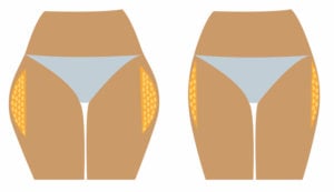 découvrez comment identifier la culotte de cheval et explorez des solutions efficaces pour l’atténuer, grâce à des conseils adaptés en alimentation, exercices ciblés et soins spécifiques.