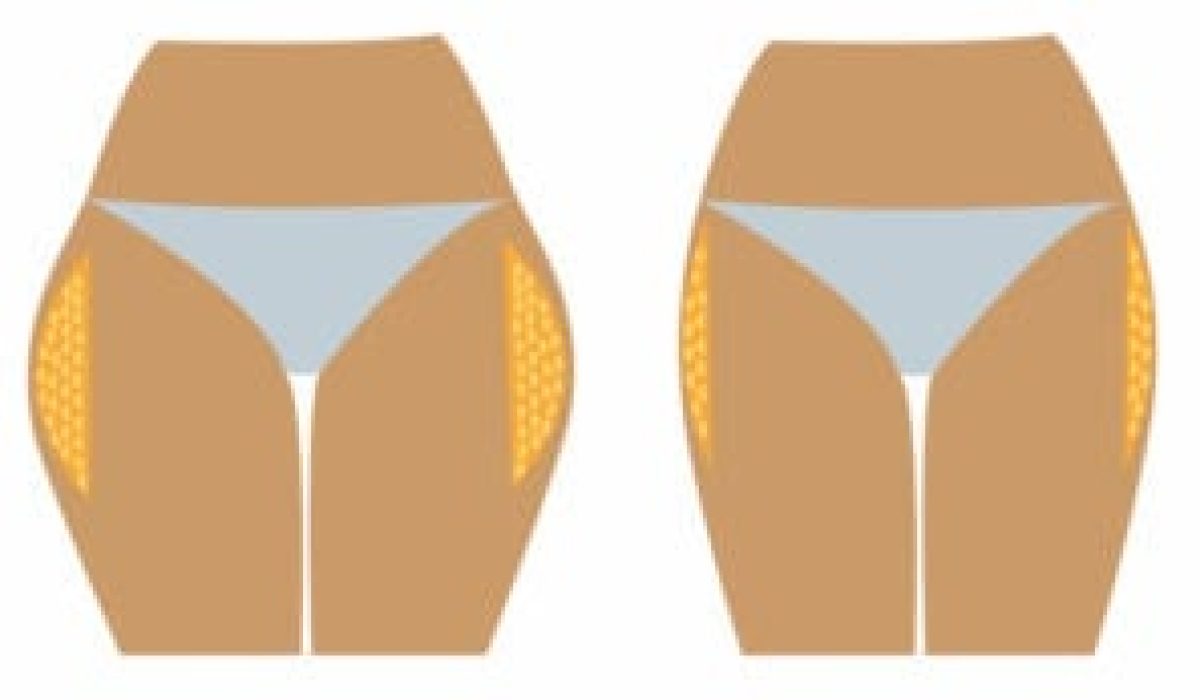 découvrez comment identifier la culotte de cheval et explorez des solutions efficaces pour l’atténuer, grâce à des conseils adaptés en alimentation, exercices ciblés et soins spécifiques.